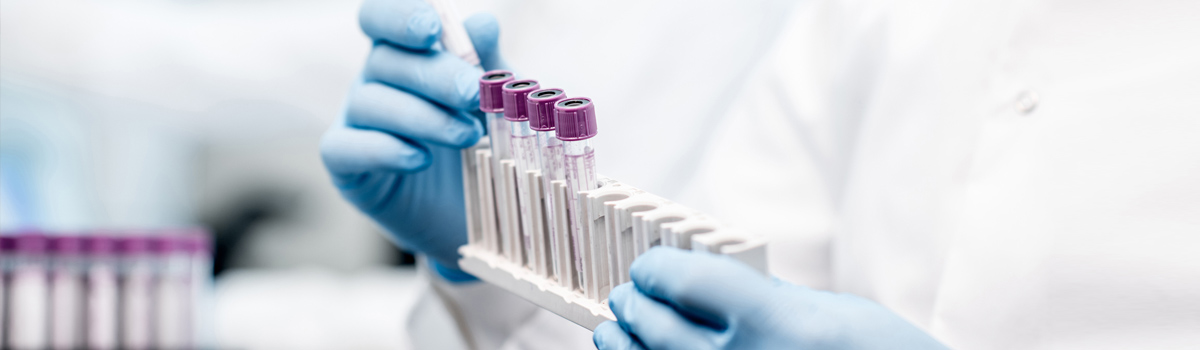 Gloved laboratory worker holding a rack with purple topped test tubes